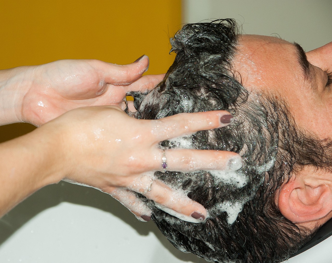 best dandruff shampoo